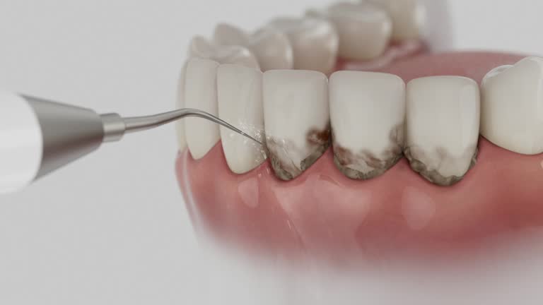 Trusted Wisdom Tooth Removal service in Wilton Center, CT - Dentist Open Now